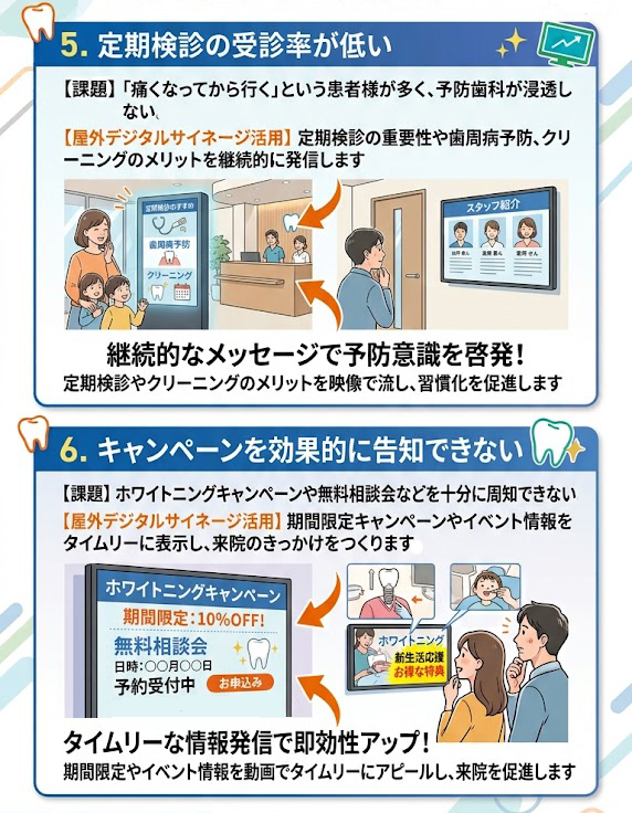 5. 定期検診の受診率が低い
課題 「痛くなってから行く」という患者様が多く、予防歯科が浸透しない。
屋外デジタルサイネージ活用 定期検診の重要性や歯周病予防、クリーニングのメリットを継続的に発信します。
6. キャンペーンを効果的に告知できない
課題 ホワイトニングキャンペーンや無料相談会などを十分に周知できない。
屋外デジタルサイネージ活用 期間限定キャンペーンやイベント情報をタイムリーに表示し、来院のきっかけをつくります。